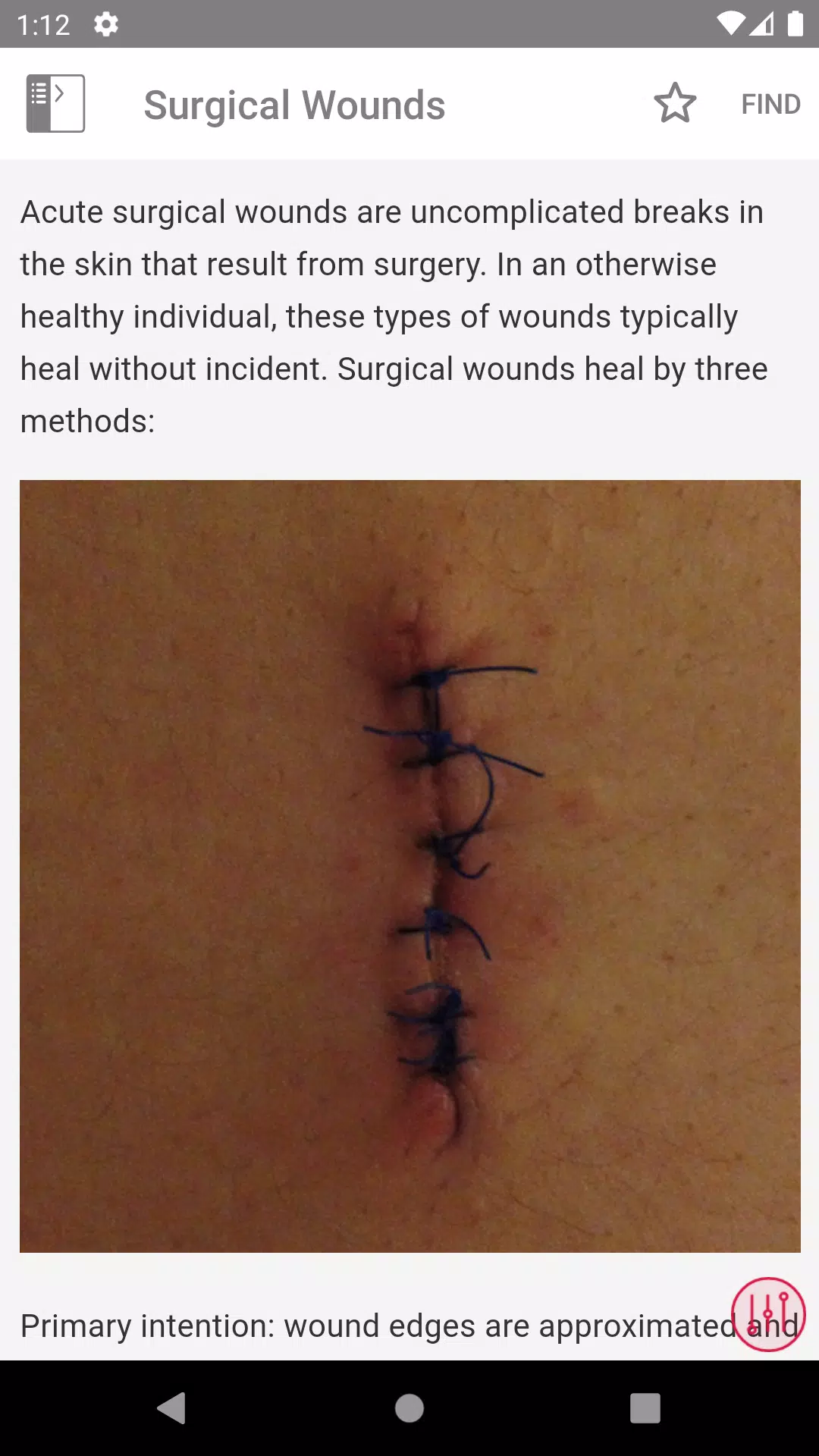 Wound Care MI Visual Screenshot 3