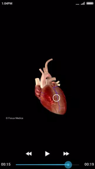 Cardiology-Animated Dictionary ဖန်သားပြင်ဓာတ်ပုံ 2