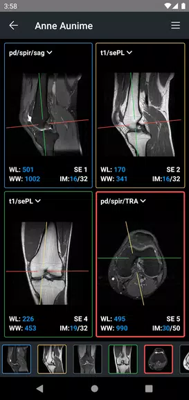 IDV - IMAIOS DICOM Viewer ภาพหน้าจอ 2