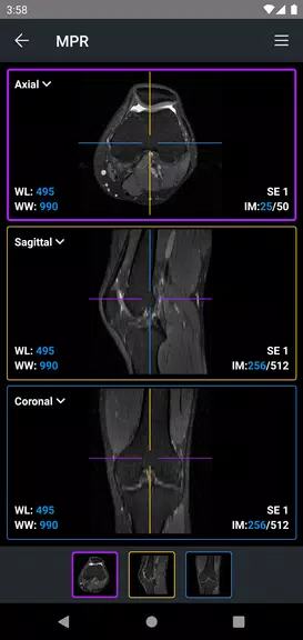 IDV - IMAIOS DICOM Viewer Screenshot 3