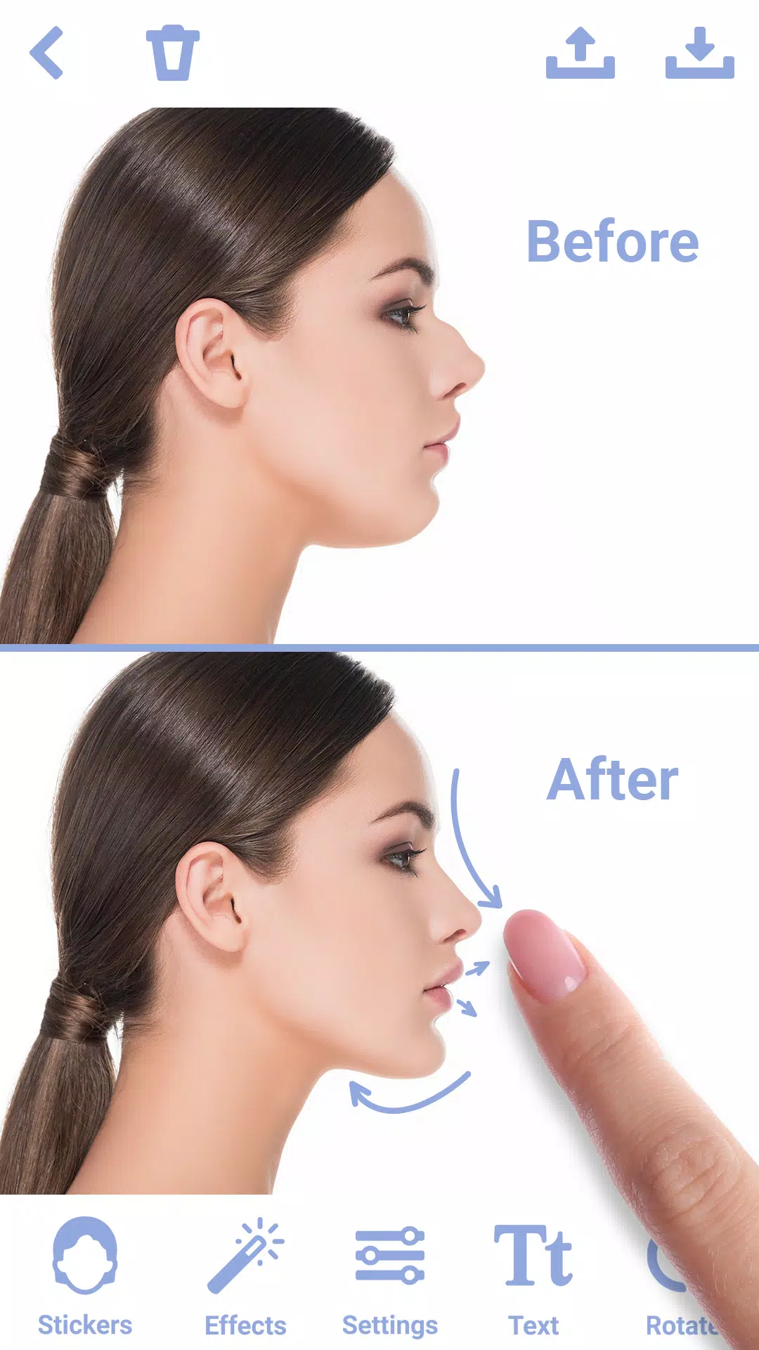 Rhinoplasty ภาพหน้าจอ 0