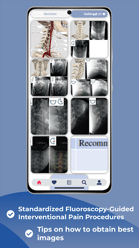 Interventional Pain App Ảnh chụp màn hình 2